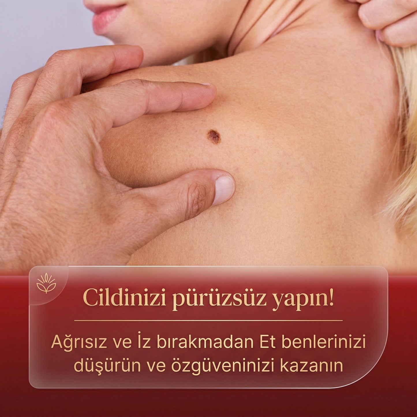 Memova Mikro İğneli Ben Ve Siğil Düşürücü Bant – 5 Günde İz Bırakmadan Düşürür
