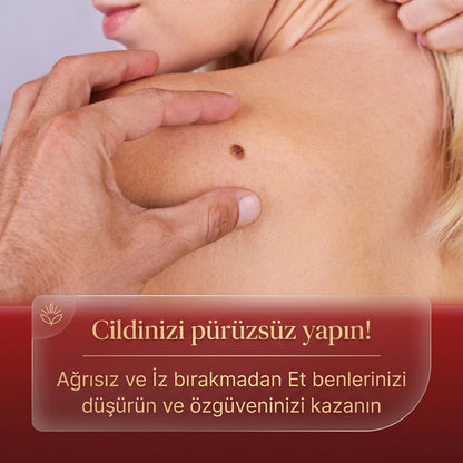 Memova Mikro İğneli Ben Ve Siğil Düşürücü Bant – 5 Günde İz Bırakmadan Düşürür