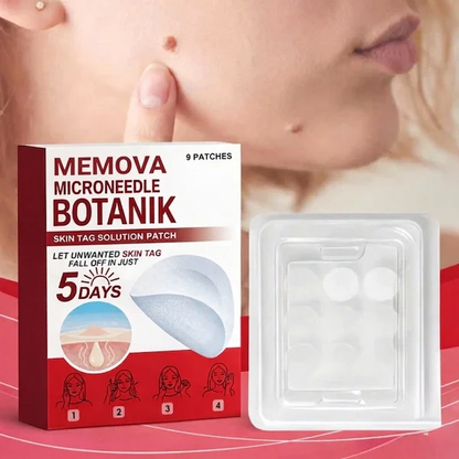 Memova Mikro İğneli Ben Ve Siğil Düşürücü Bant – 5 Günde İz Bırakmadan Düşürür